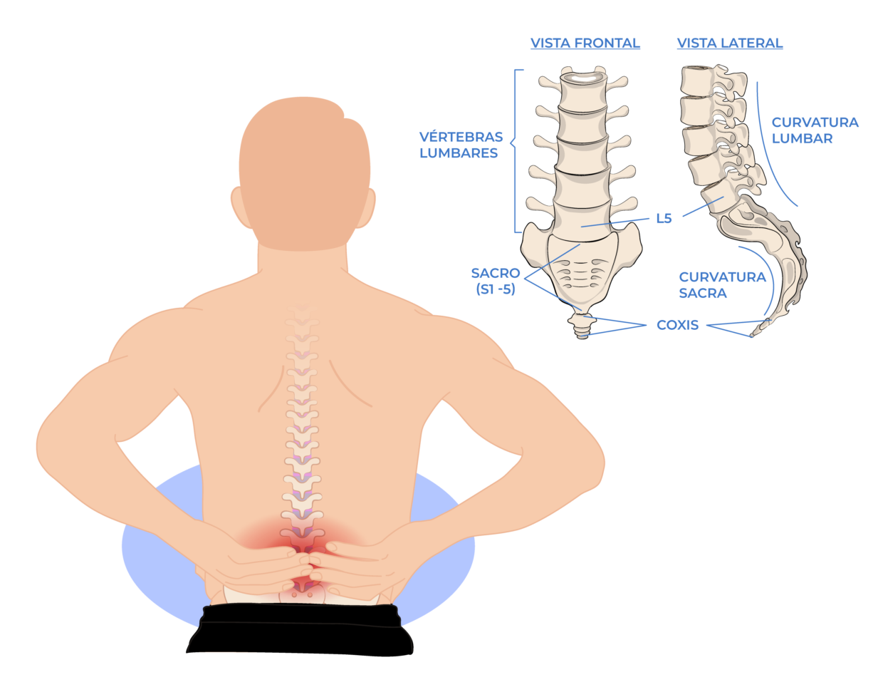 Dolor de Baja Espalda, Dolor Lumbar, Tratamiento